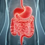 Câncer de intestino: 7 sinais de alerta que você não deve ignorar