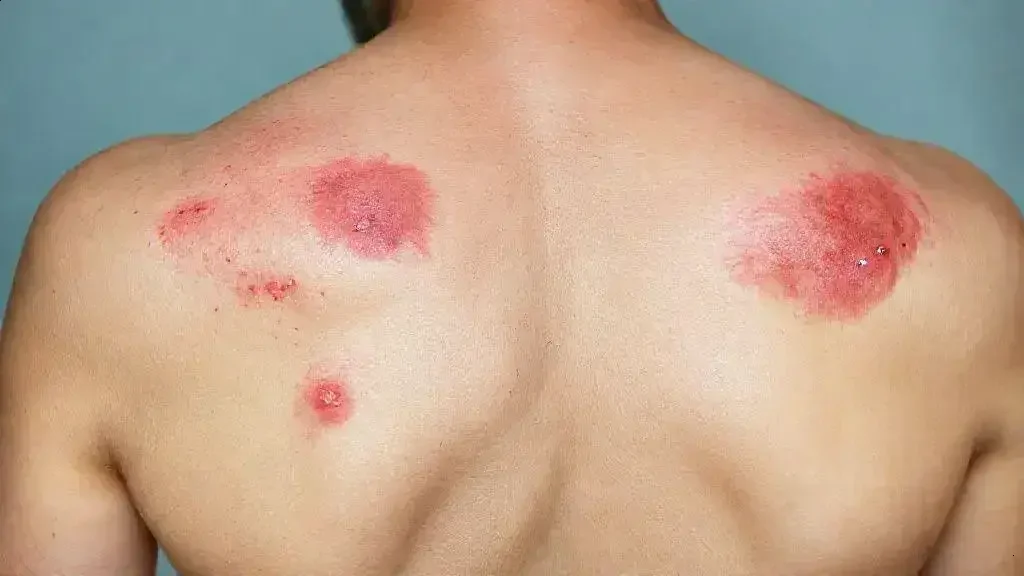 Sinais e sintomas: como identificar Sinais e sintomas: como identificar